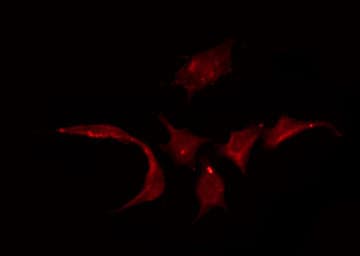 SLC22A3 / OCT3 Antibody