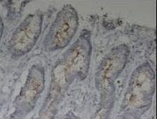 EMA / MUC1 Antibody (aa1192-1241)