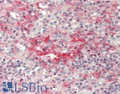 SIPR2 / S1P2 / EDG5 Antibody