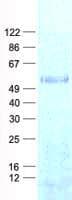 Human IP6K1 Protein (Recombinant His, N-Terminal)