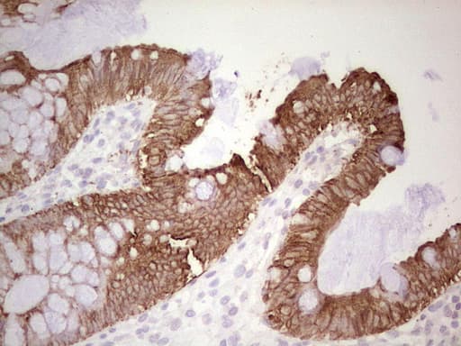 ABCB1 / MDR1 / P Glycoprotein Antibody (aa995-1280, clone OTI1A7)