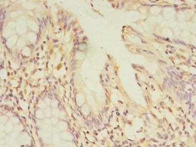 PELO Antibody