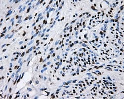 Monoclonal Mouse anti-Human RIP1 / RALBP1 Antibody (clone OTI11B2, IHC, IF, WB)