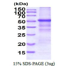 Human GPNMB / Osteoactivin Protein (Recombinant His)
