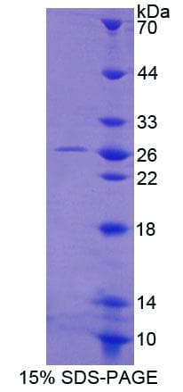 Human MCM3 Protein (Recombinant His-T7, N-terminus)