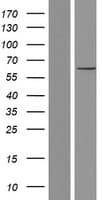 CNOT6 Protein (Over-Expression Lysate Myc-DDK (Flag))