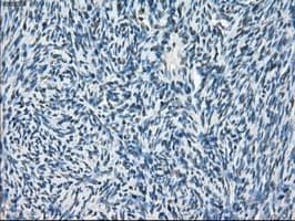Monoclonal Mouse anti-Human CYPOR / POR Antibody (clone OTI3F10, IHC, IF, WB)