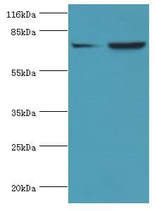 ACSL4 / FACL4 Antibody