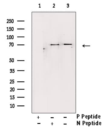 Polyclonal Rabbit anti-Human STK11 / LKB1 Antibody (phospho-Ser428, IHC, IF, WB)