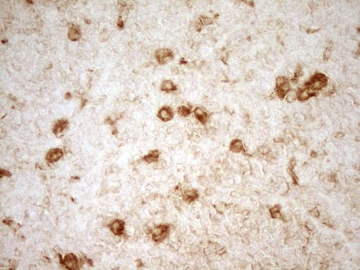 GRN / Granulin Antibody (aa327-593, clone OTI1F9)