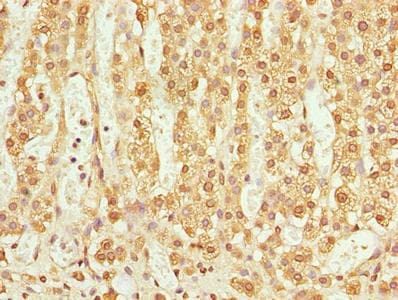 TMEM205 Antibody