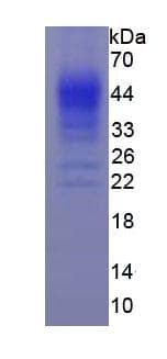 Human IFN Gamma / Interferon Gamma Protein (Recombinant His, N-Terminal)