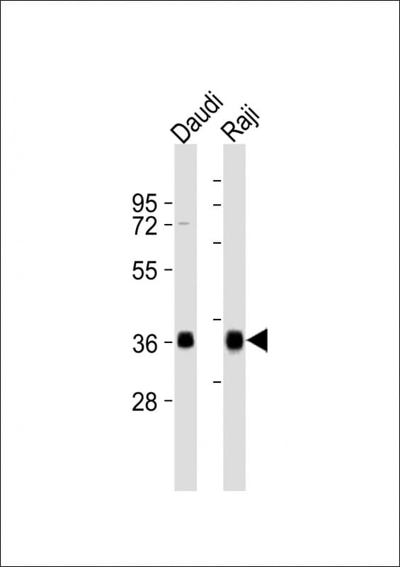 HLA-DQA1 Antibody (aa188-222)
