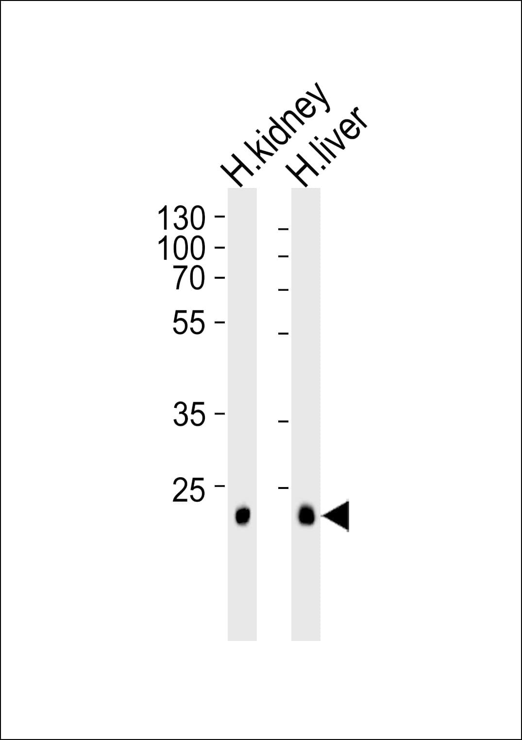 Polyclonal Rabbit anti-Human CLDN14 / Claudin 14 Antibody (aa172-200, WB)