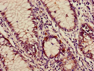 AP3M2 Antibody