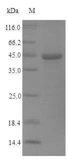 Human NS1 Protein (Recombinant 6His-SUMO, N-terminus)