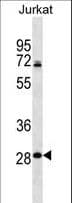 RPL11 / Ribosomal Protein L11 Antibody (aa1-30)