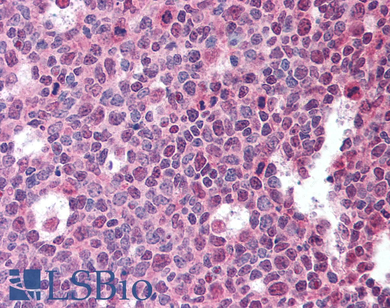 IHC-plus™ Monoclonal Mouse anti-Human BAFF / TNFSF13B Antibody (clone T7-241, IHC)