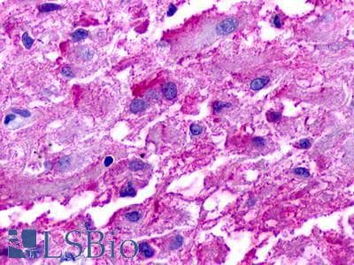 PathPlus™ TAAR2 / GPR58 Antibody (Cytoplasmic Domain)