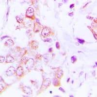 MRPL49 Antibody (Internal)