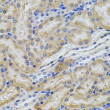 PCSK9 Antibody