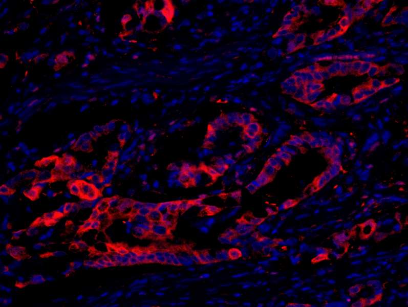 Polyclonal Rabbit anti-Human EEF2K Antibody (aa675-725, IHC, IF)