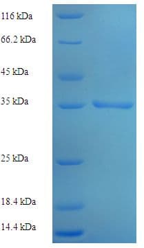Human MCTS1 Protein (Recombinant His-SUMO)