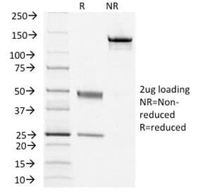 Monoclonal Mouse anti-Human TSH Receptor / TSHR Antibody (clone TSHRB/1405, IHC, IF)