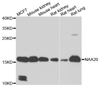 Polyclonal Rabbit anti-Human NAT5 / NAA20 Antibody (IHC, IF, WB)