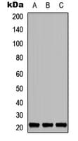 TNFAIP8L1 Antibody (Internal)
