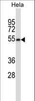 VISA / MAVS Antibody (aa477-505)