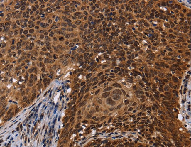 FASTKD5 Antibody