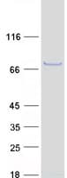 Human CHST15 Protein (Recombinant Myc-DDK (Flag))