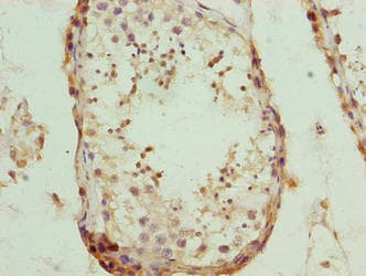 NUP43 Antibody