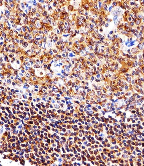 NFKB1 / NF-Kappa-B Antibody (clone 1298CT792.105.117.133)