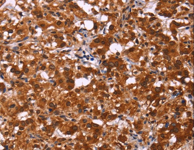 Polyclonal Rabbit anti-Human ART5 Antibody (IHC)