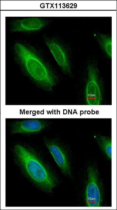 ASL / Argininosuccinate Lyase Antibody (aa13-261)