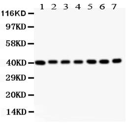 DCN / Decorin Antibody (aa31-359)