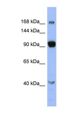 Polyclonal Rabbit anti-Human MED23 / SUR2 Antibody (N-Terminus, WB)