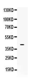 MC2R / ACTHR / ACTH Receptor Antibody