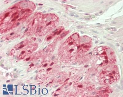 IHC-plus™ Polyclonal Rabbit anti-Human S100B / S100 Beta Antibody (aa 2-92, IHC)