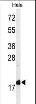 MMGT1 Antibody (aa103-131)