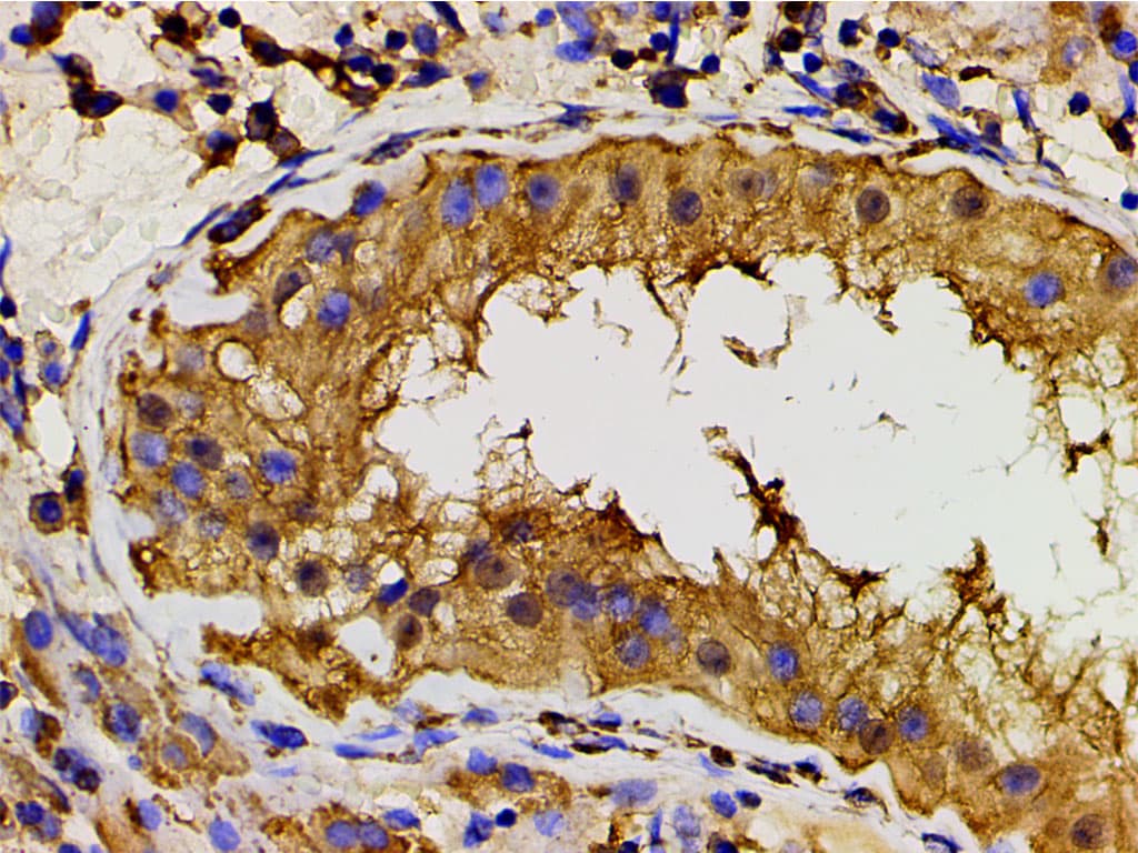 PIK3R1 / p85 Alpha Antibody (phospho-Tyr607)