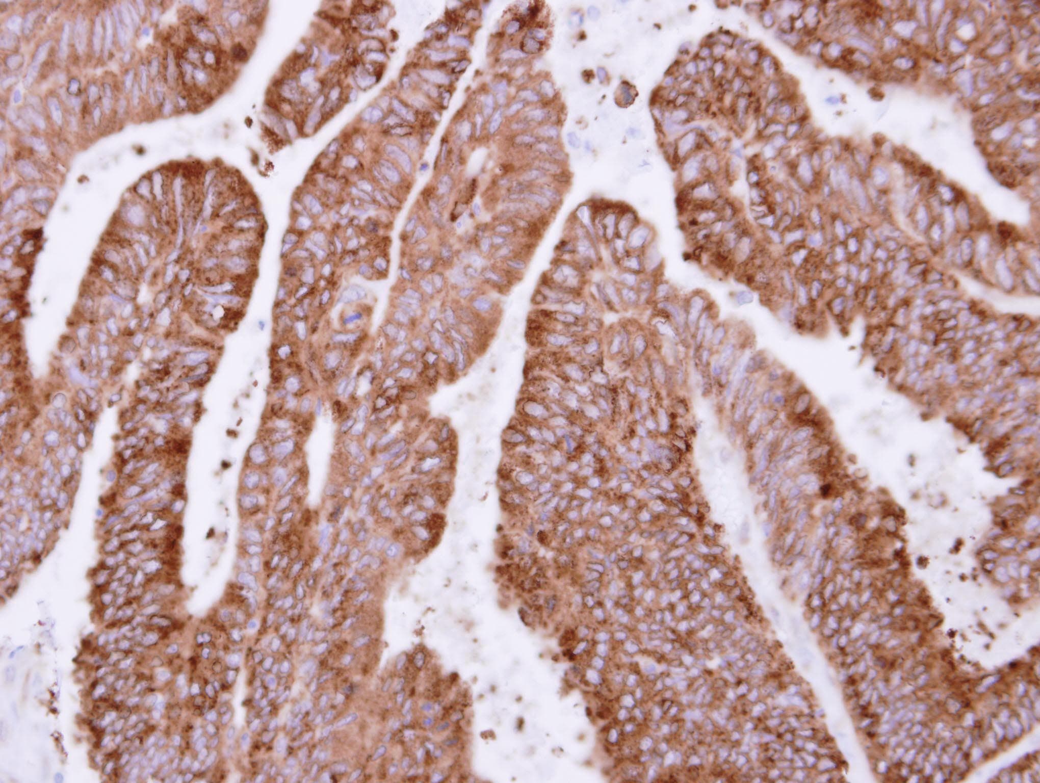 Polyclonal Rabbit anti-Human OSGEP Antibody (aa140-335, IHC, WB)