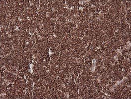 MAGEA4 Antibody (clone OTI2C1)