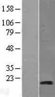 SYNJ2BP / OMP25 Protein (Over-Expression Lysate Myc-DDK (Flag))