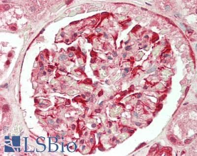 IHC-plus™ Polyclonal Rabbit anti-Salmon HSP70 / Heat Shock Protein 70 Antibody (IHC, WB)