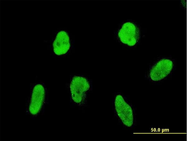 FLI1 Antibody (clone 1G8)