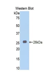 PRL / Prolactin Antibody (aa1-227, PE)