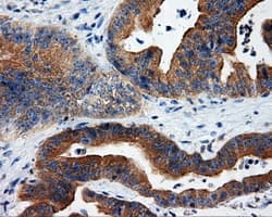 Monoclonal Mouse anti-Human RIP1 / RALBP1 Antibody (clone OTI2A6, IHC, IF, WB)